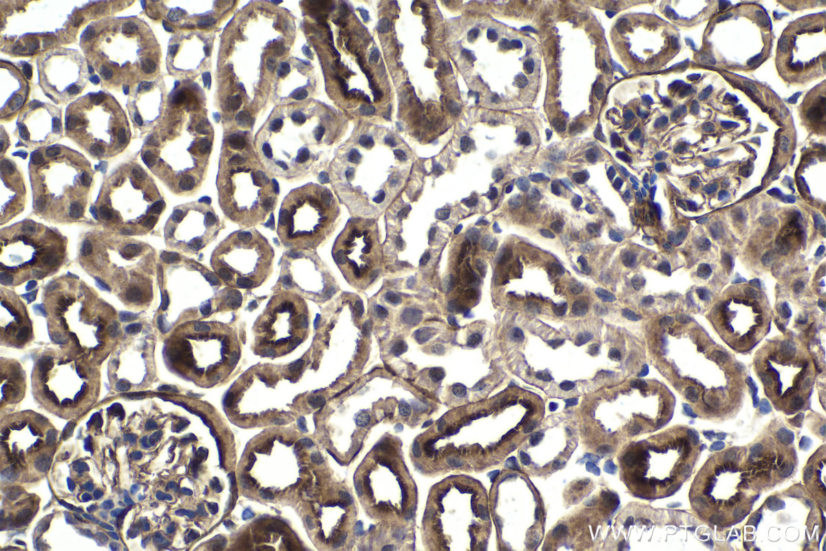 Immunohistochemistry (IHC) staining of mouse kidney tissue using ZC3H12A Polyclonal antibody (25009-1-AP)