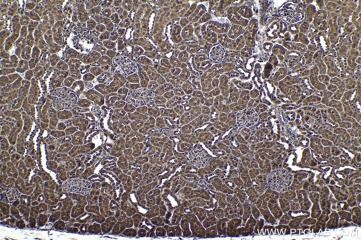 Immunohistochemistry (IHC) staining of rat kidney tissue using ZC3H12A Polyclonal antibody (25009-1-AP)