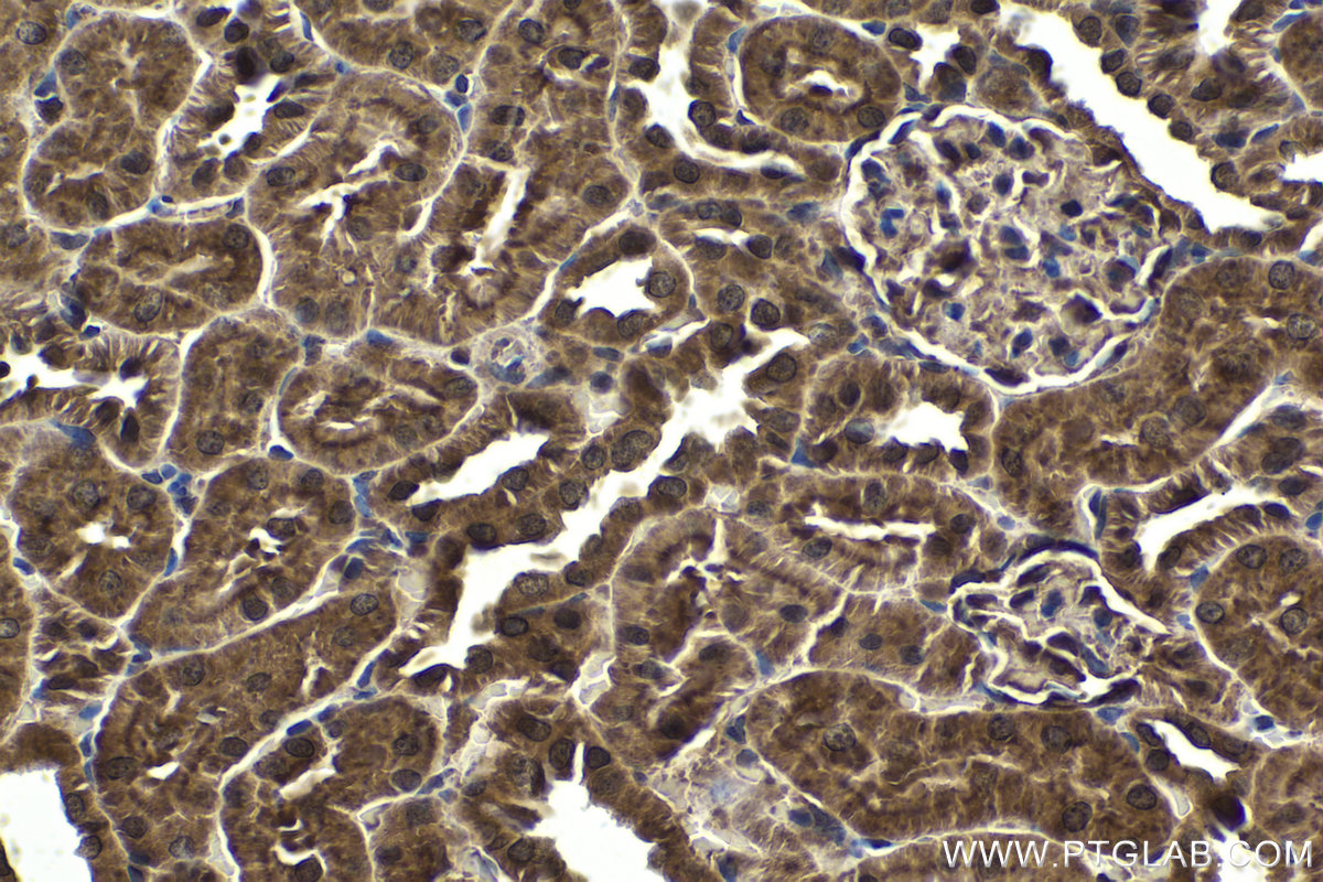 Immunohistochemistry (IHC) staining of rat kidney tissue using ZC3H12A Polyclonal antibody (25009-1-AP)