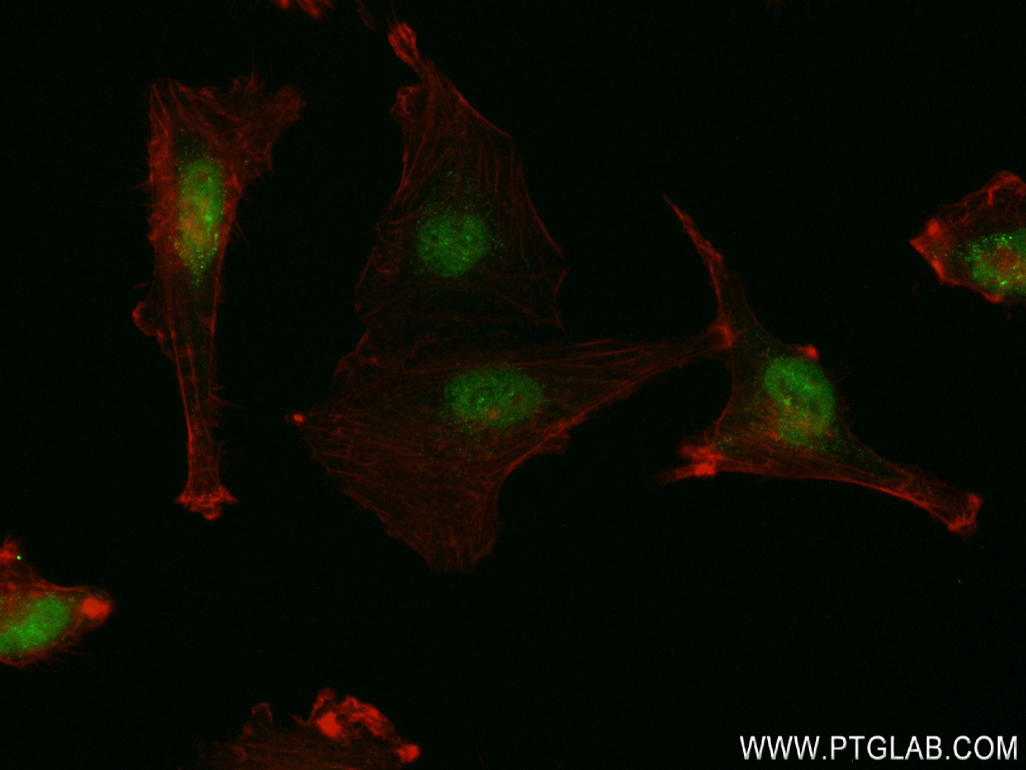 Immunofluorescence (IF) / fluorescent staining of U-251 cells using ZC3H12A Recombinant antibody (84521-5-RR)