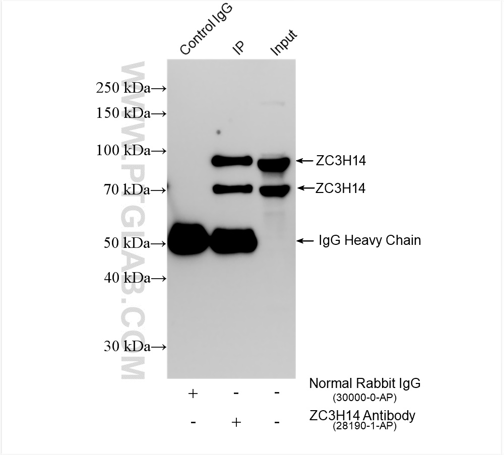 Immunoprecipitation (IP) experiment of HEK-293T cells using ZC3H14 Polyclonal antibody (28190-1-AP)