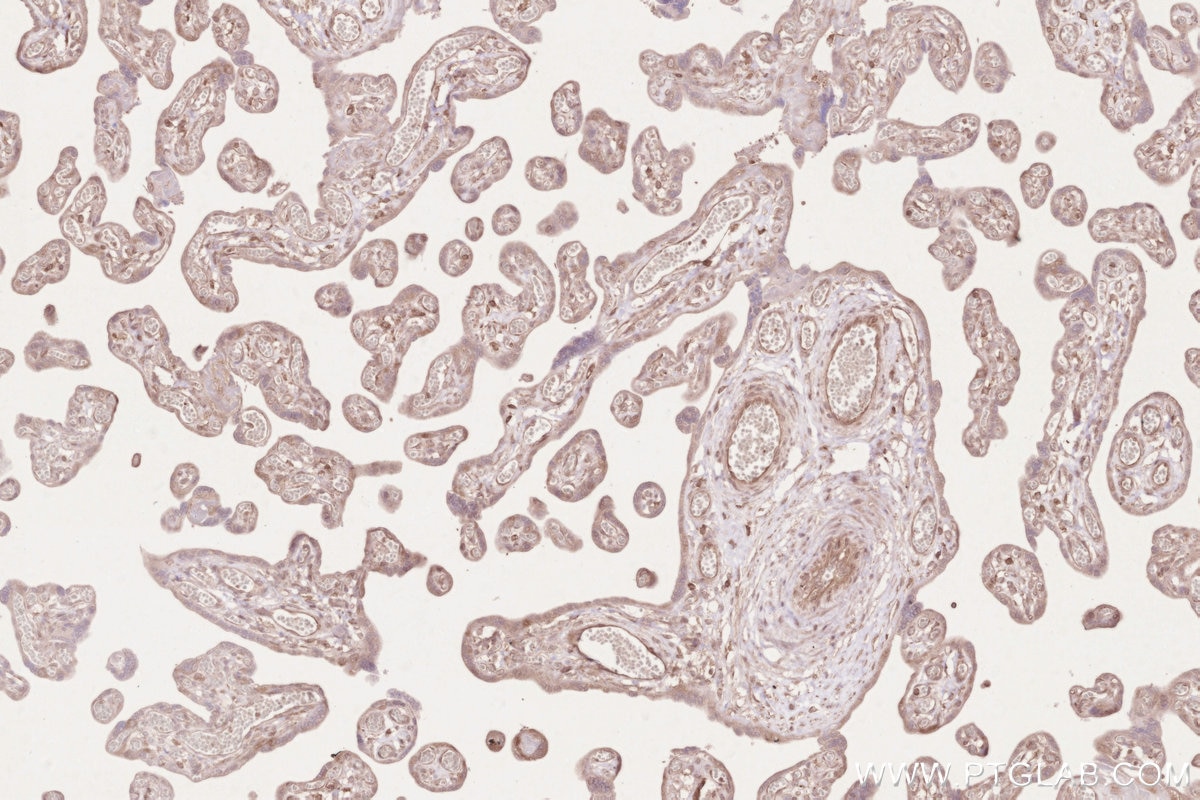 Immunohistochemistry (IHC) staining of human placenta tissue using ZC3HAV1 Polyclonal antibody (16820-1-AP)