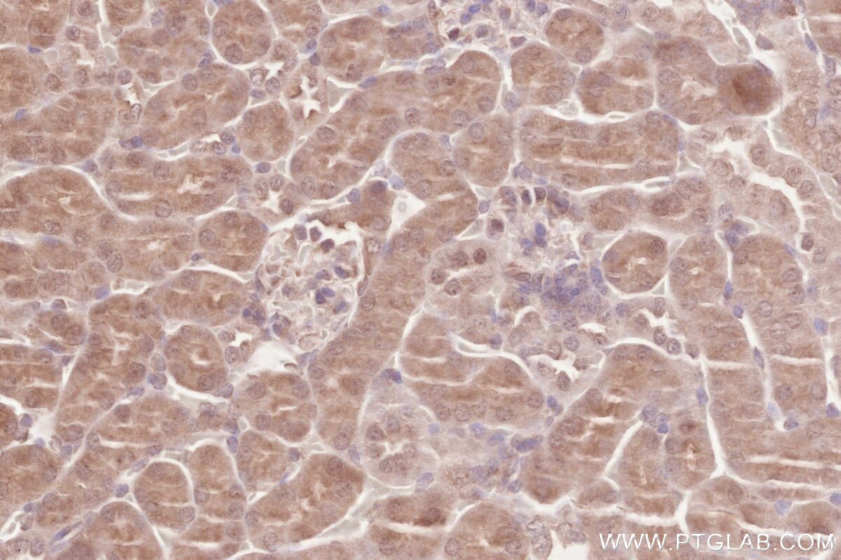 Immunohistochemistry (IHC) staining of mouse kidney tissue using ZC3HAV1 Polyclonal antibody (16820-1-AP)