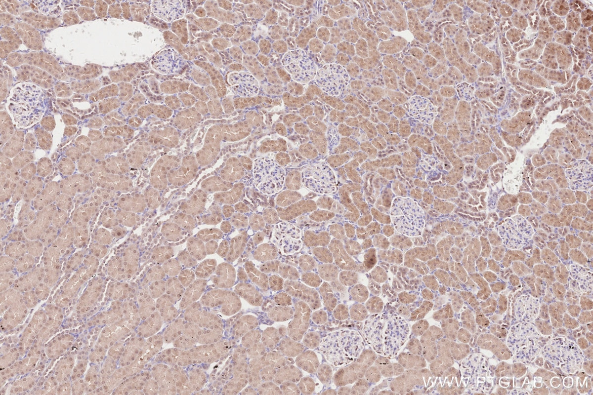 Immunohistochemistry (IHC) staining of rat kidney tissue using ZC3HAV1 Polyclonal antibody (16820-1-AP)