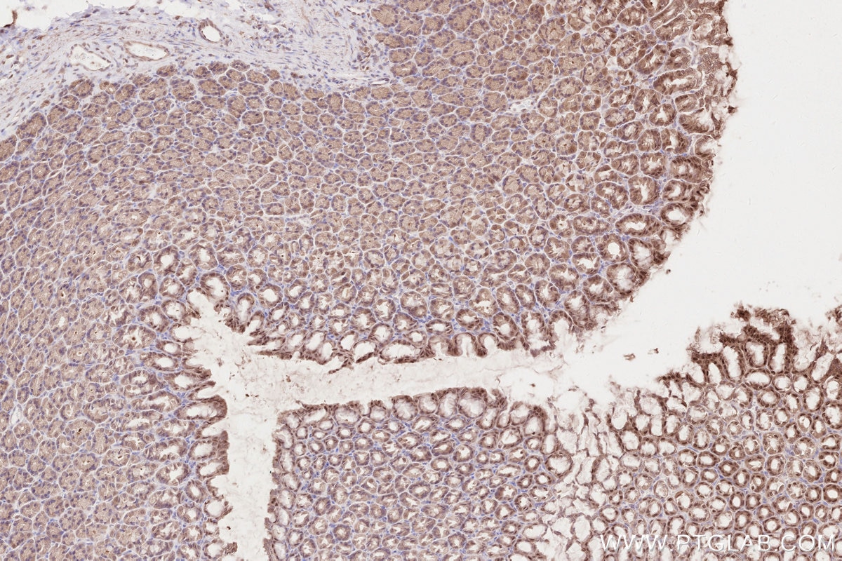 Immunohistochemistry (IHC) staining of rat stomach tissue using ZC3HAV1 Polyclonal antibody (16820-1-AP)