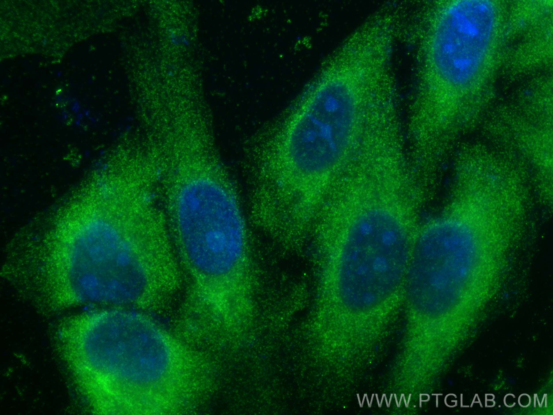 Immunofluorescence (IF) / fluorescent staining of HepG2 cells using ZC3HAV1 Monoclonal antibody (66413-1-Ig)