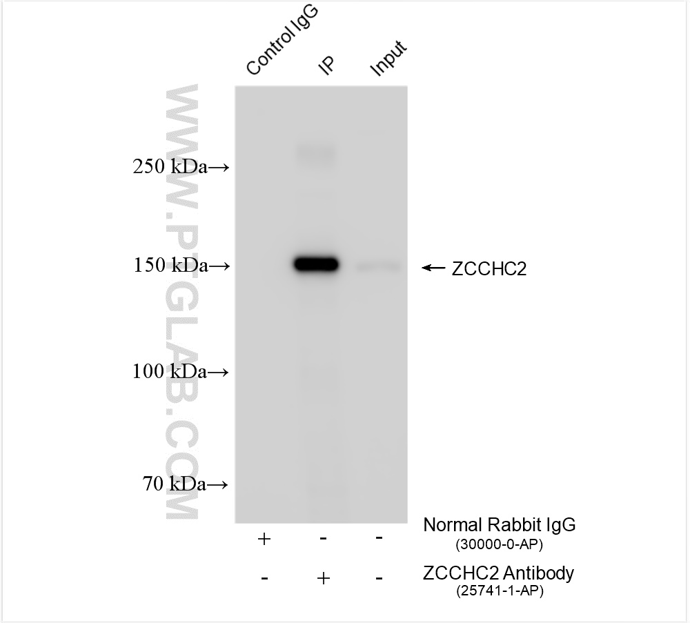 Immunoprecipitation (IP) experiment of HeLa cells using ZCCHC2 Polyclonal antibody (25741-1-AP)