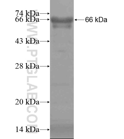 ZCCHC8 fusion protein Ag19993 SDS-PAGE