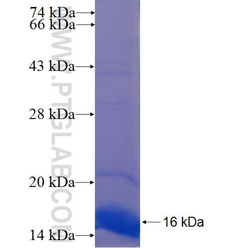 ZDHHC11 fusion protein Ag22419 SDS-PAGE