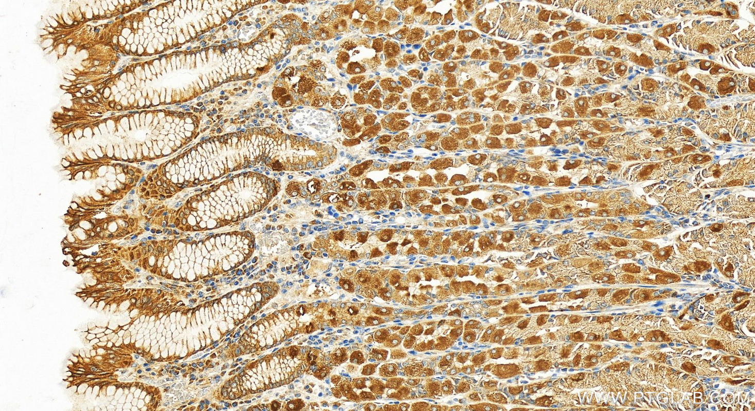 Immunohistochemistry (IHC) staining of human stomach tissue using ZDHHC13 Polyclonal antibody (24759-1-AP)