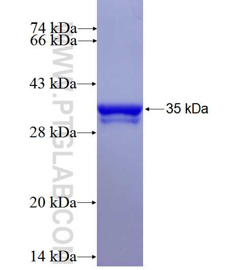 ZDHHC20 fusion protein Ag27707 SDS-PAGE