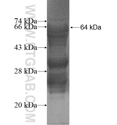 ZDHHC5 fusion protein Ag15022 SDS-PAGE