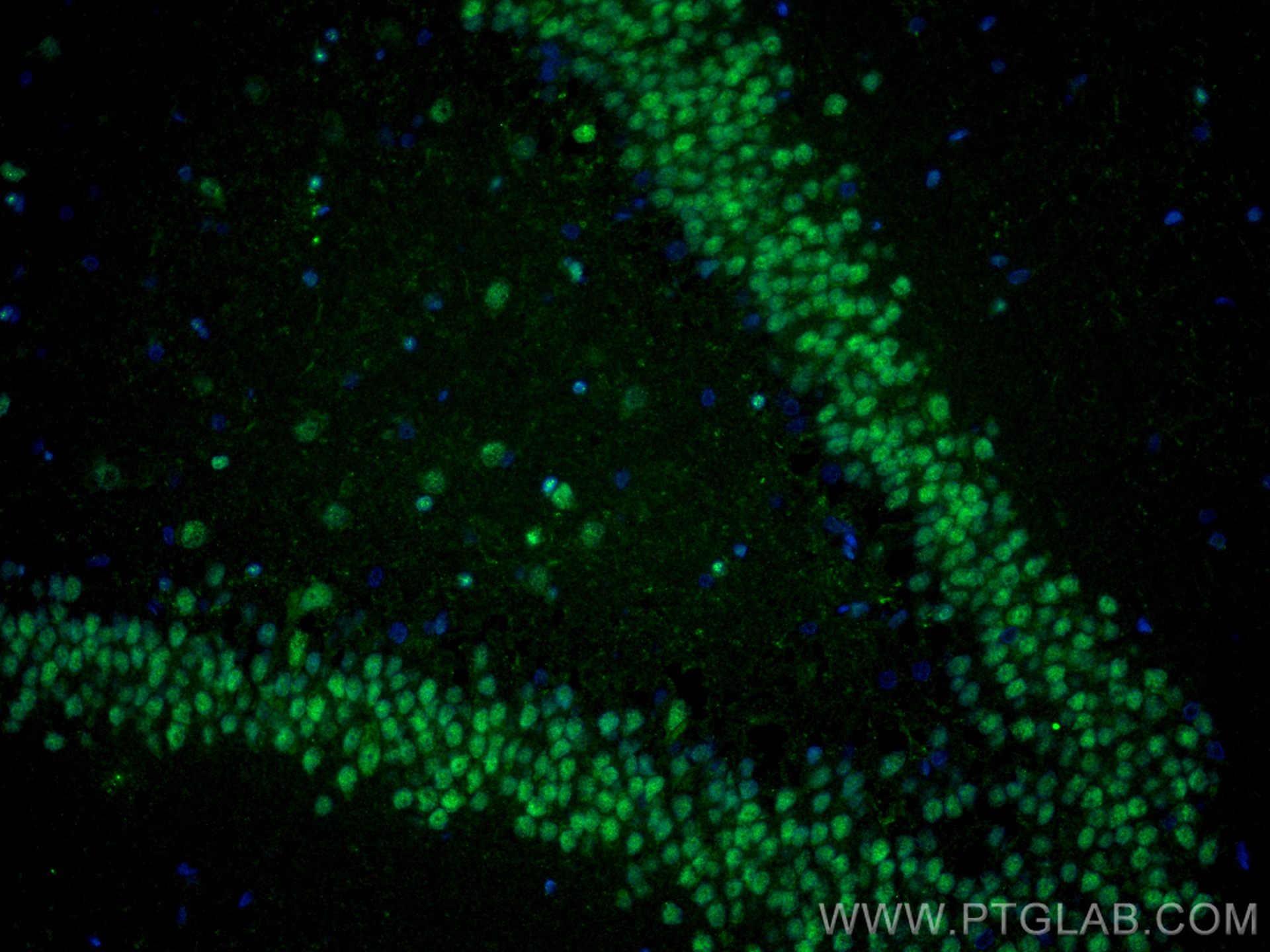 Immunofluorescence (IF) / fluorescent staining of rat brain tissue using ZEB2 Recombinant antibody (82020-1-RR)