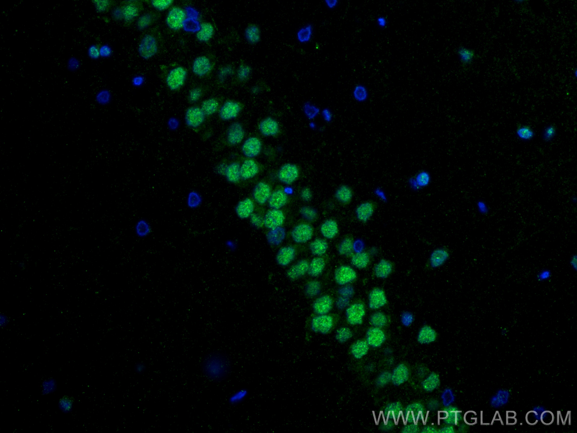 Immunofluorescence (IF) / fluorescent staining of rat brain tissue using ZEB2 Recombinant antibody (82020-1-RR)