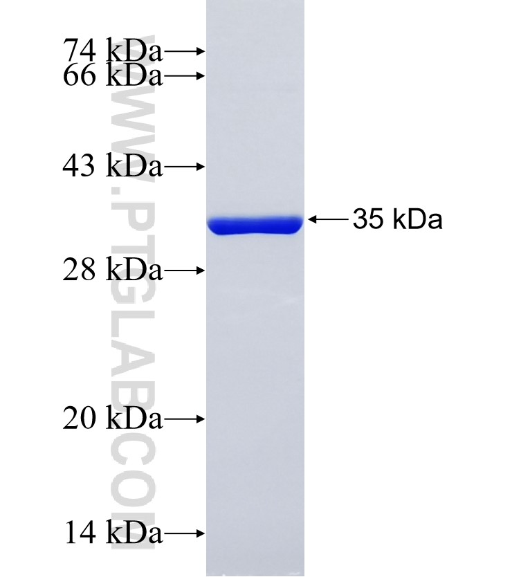 ZFAND6 fusion protein Ag19513 SDS-PAGE