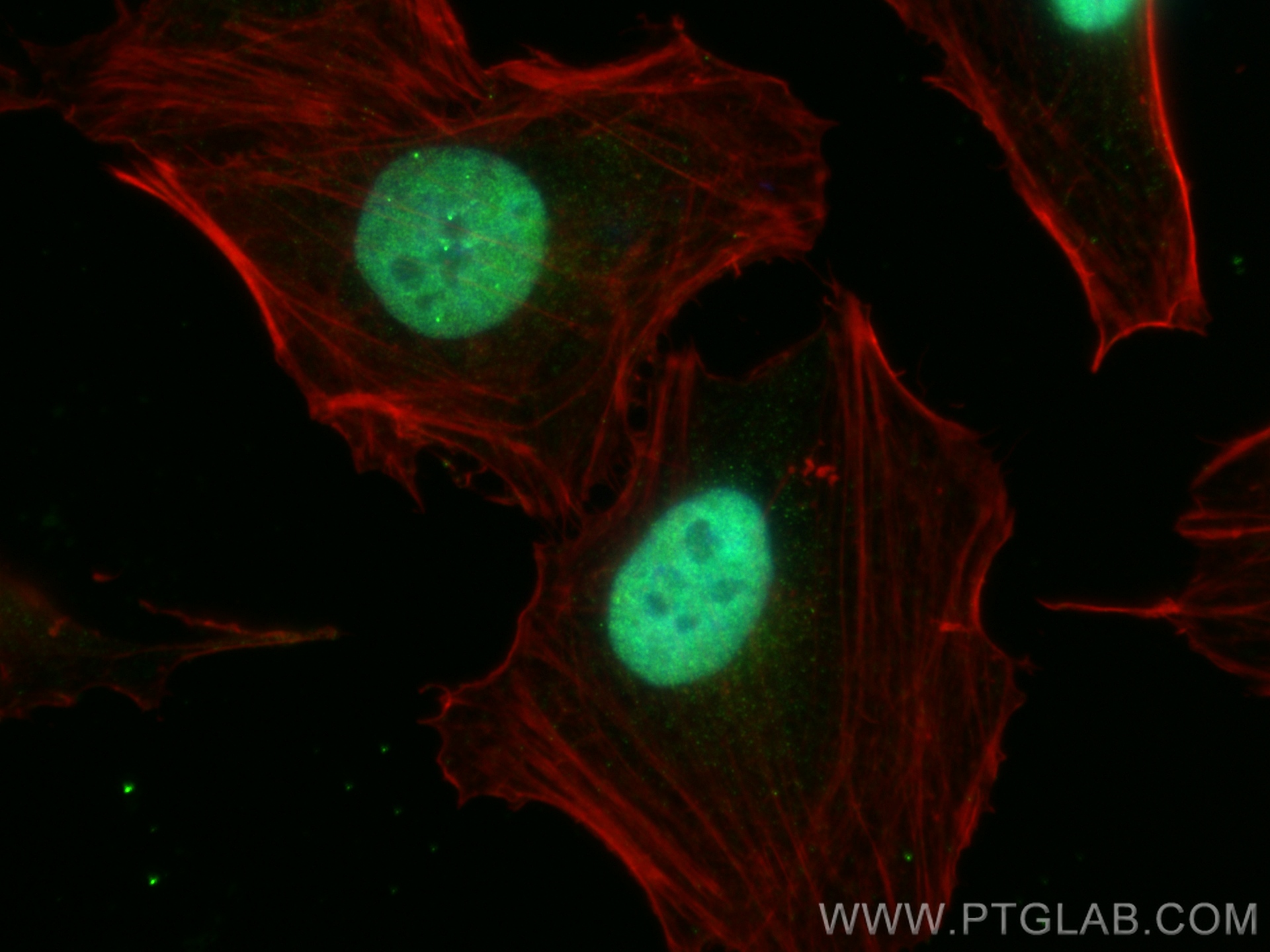 Immunofluorescence (IF) / fluorescent staining of HeLa cells using ZFHX3 Polyclonal antibody (20157-1-AP)