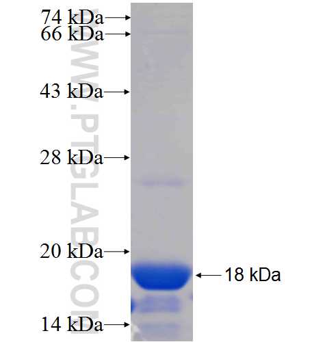 ZFP30 fusion protein Ag25037 SDS-PAGE