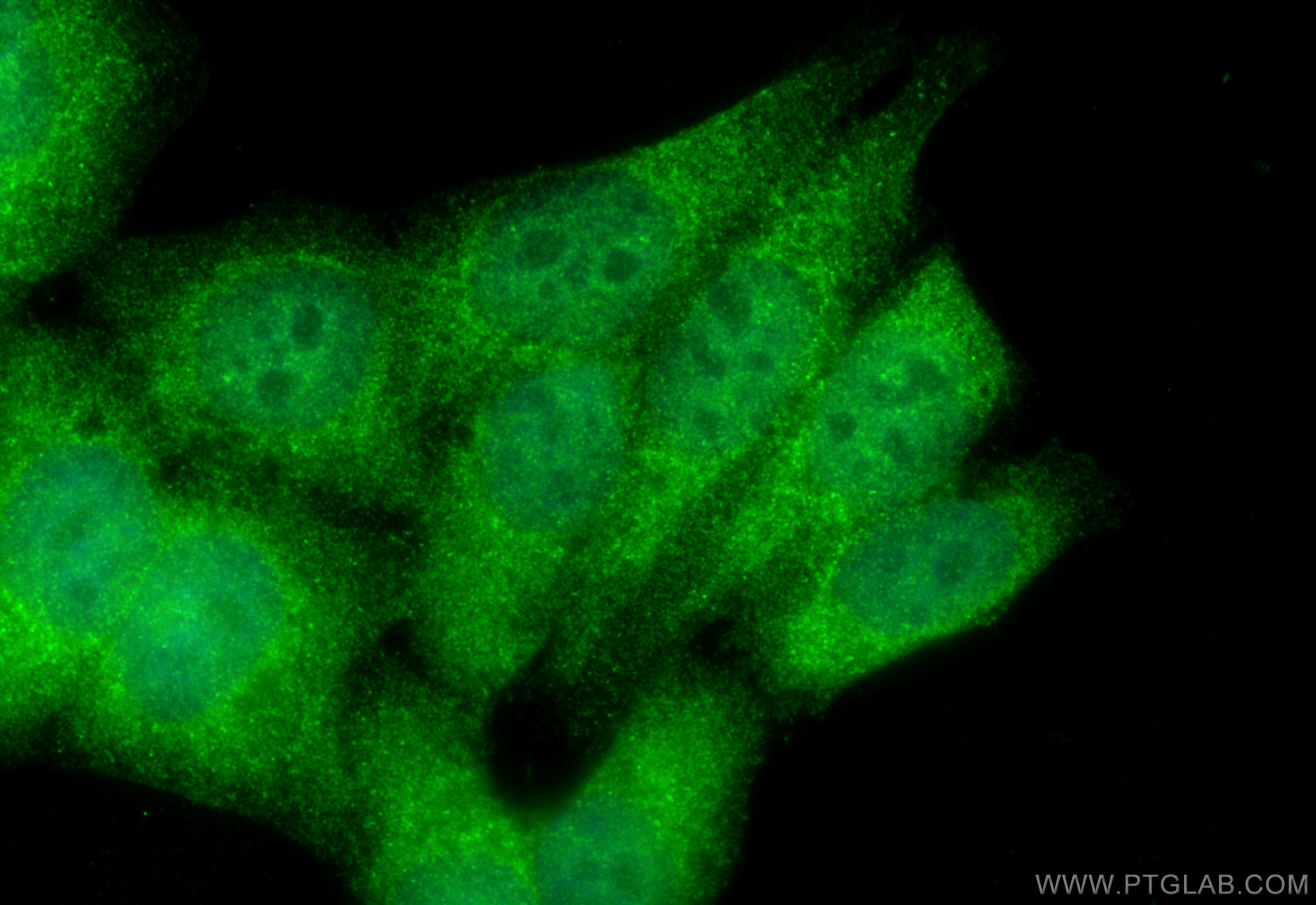 Immunofluorescence (IF) / fluorescent staining of HepG2 cells using ZFP36 Polyclonal antibody (12737-1-AP)