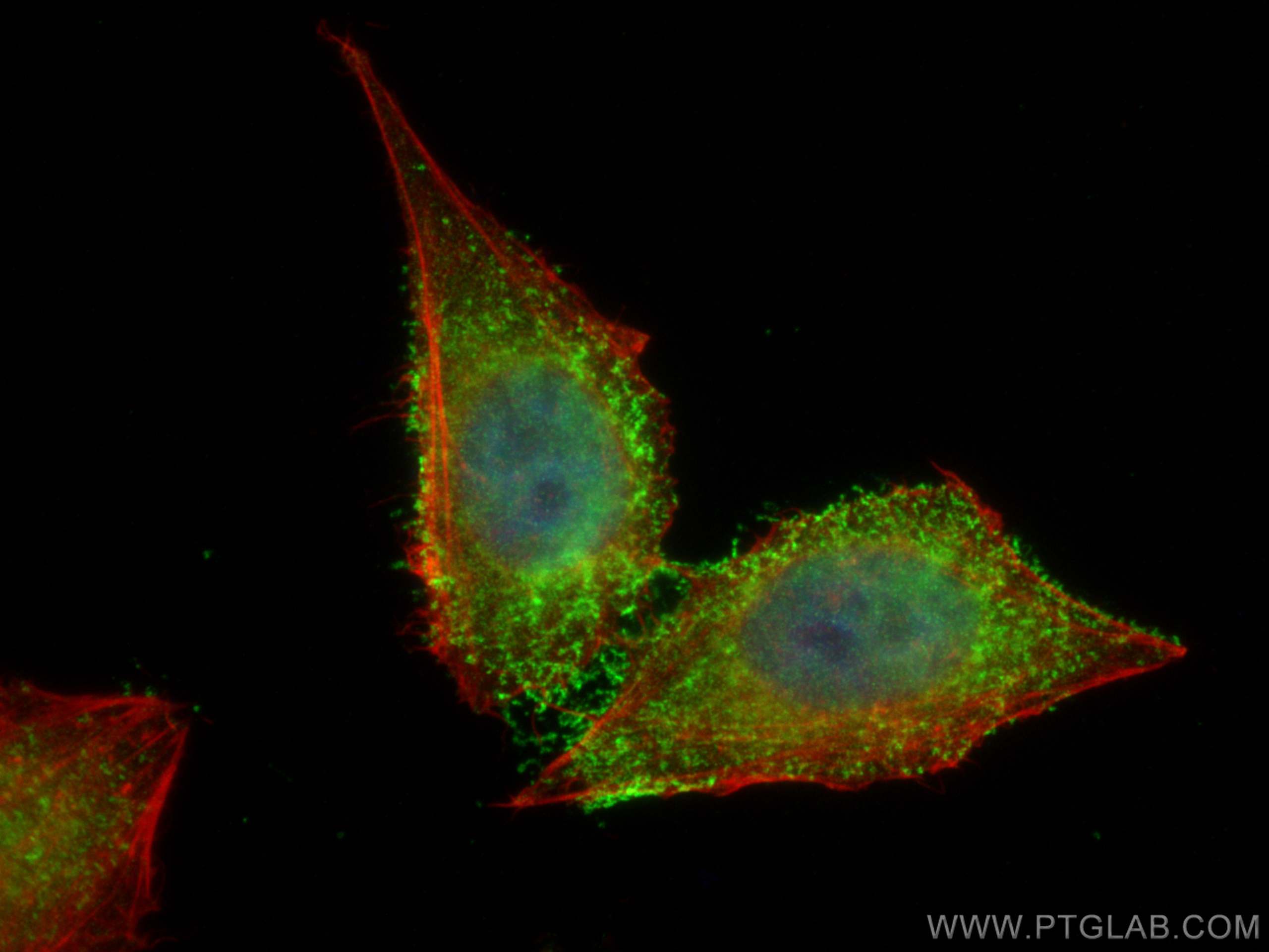 Immunofluorescence (IF) / fluorescent staining of HepG2 cells using ZFP36L1/2 Polyclonal antibody (12306-1-AP)