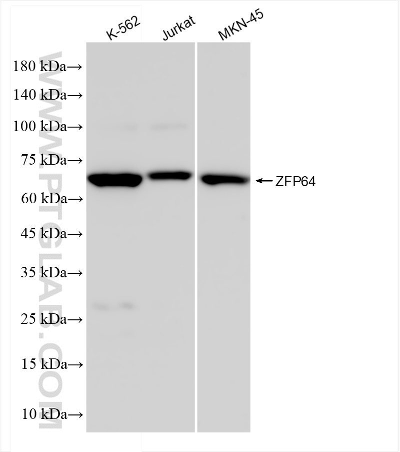 Western Blot (WB) analysis of various lysates using ZFP64 Recombinant antibody (83825-3-RR)