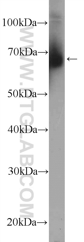 Western Blot (WB) analysis of mouse testis tissue using ZFP90 Polyclonal antibody (26120-1-AP)