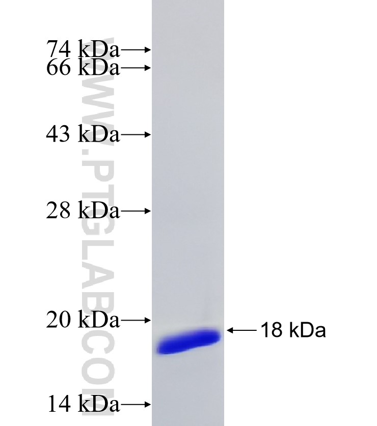 ZFX fusion protein Ag26551 SDS-PAGE