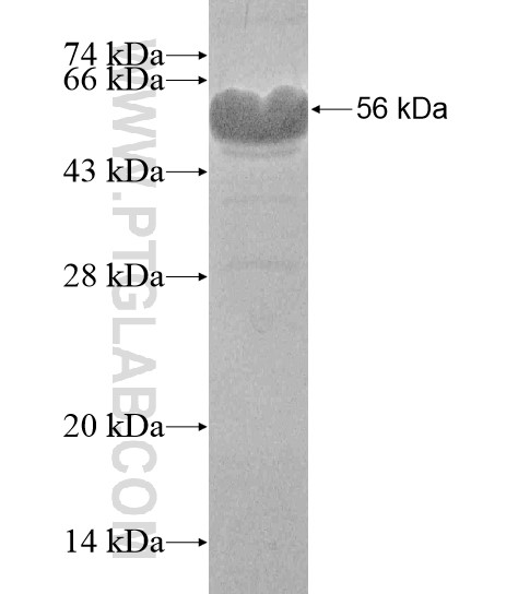 ZFY fusion protein Ag19646 SDS-PAGE