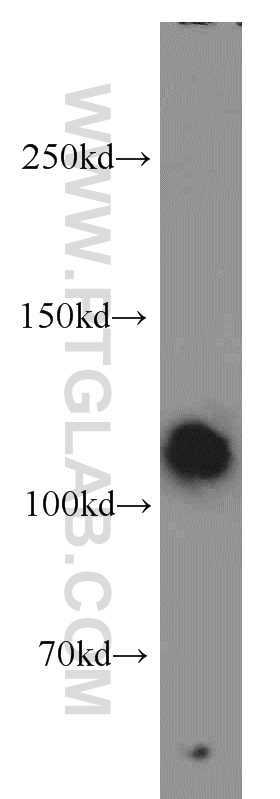 Western Blot (WB) analysis of A549 cells using Rabenosyn 5 Polyclonal antibody (22218-1-AP)