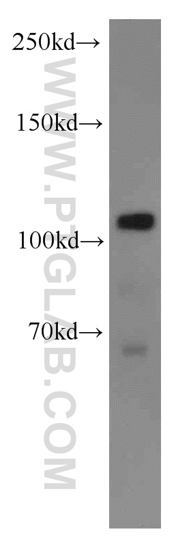 Western Blot (WB) analysis of mouse heart tissue using Rabenosyn 5 Polyclonal antibody (22218-1-AP)