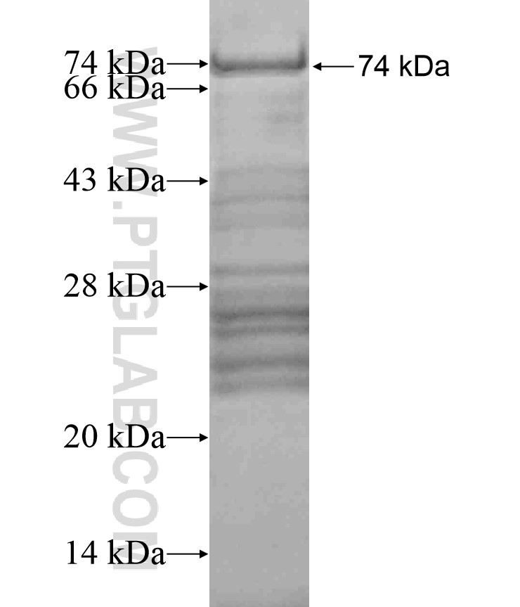 ZFYVE20 fusion protein Ag17554 SDS-PAGE