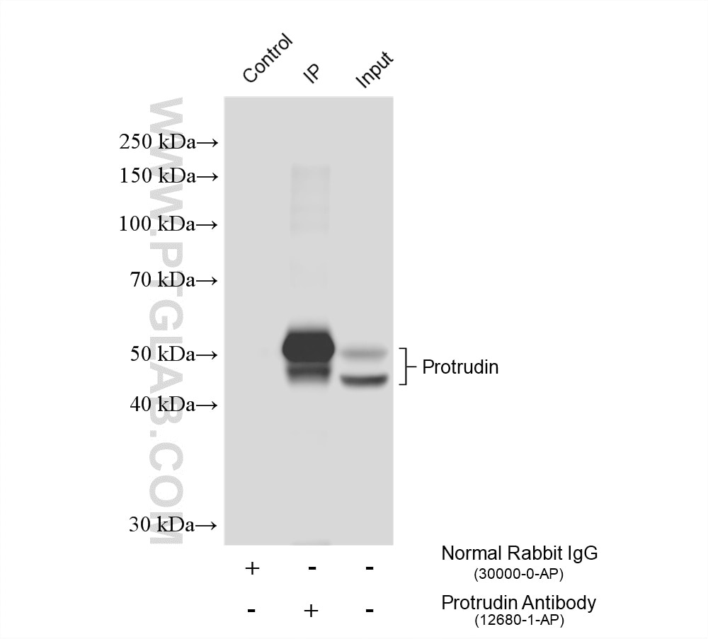 Immunoprecipitation (IP) experiment of mouse brain tissue using Protrudin Polyclonal antibody (12680-1-AP)