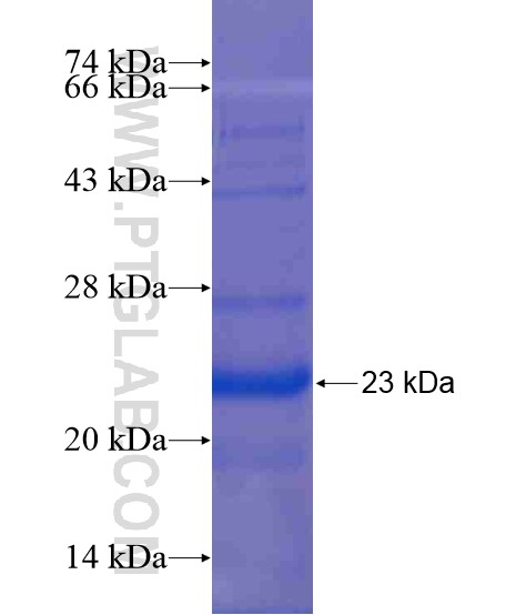 ZG16B fusion protein Ag20751 SDS-PAGE