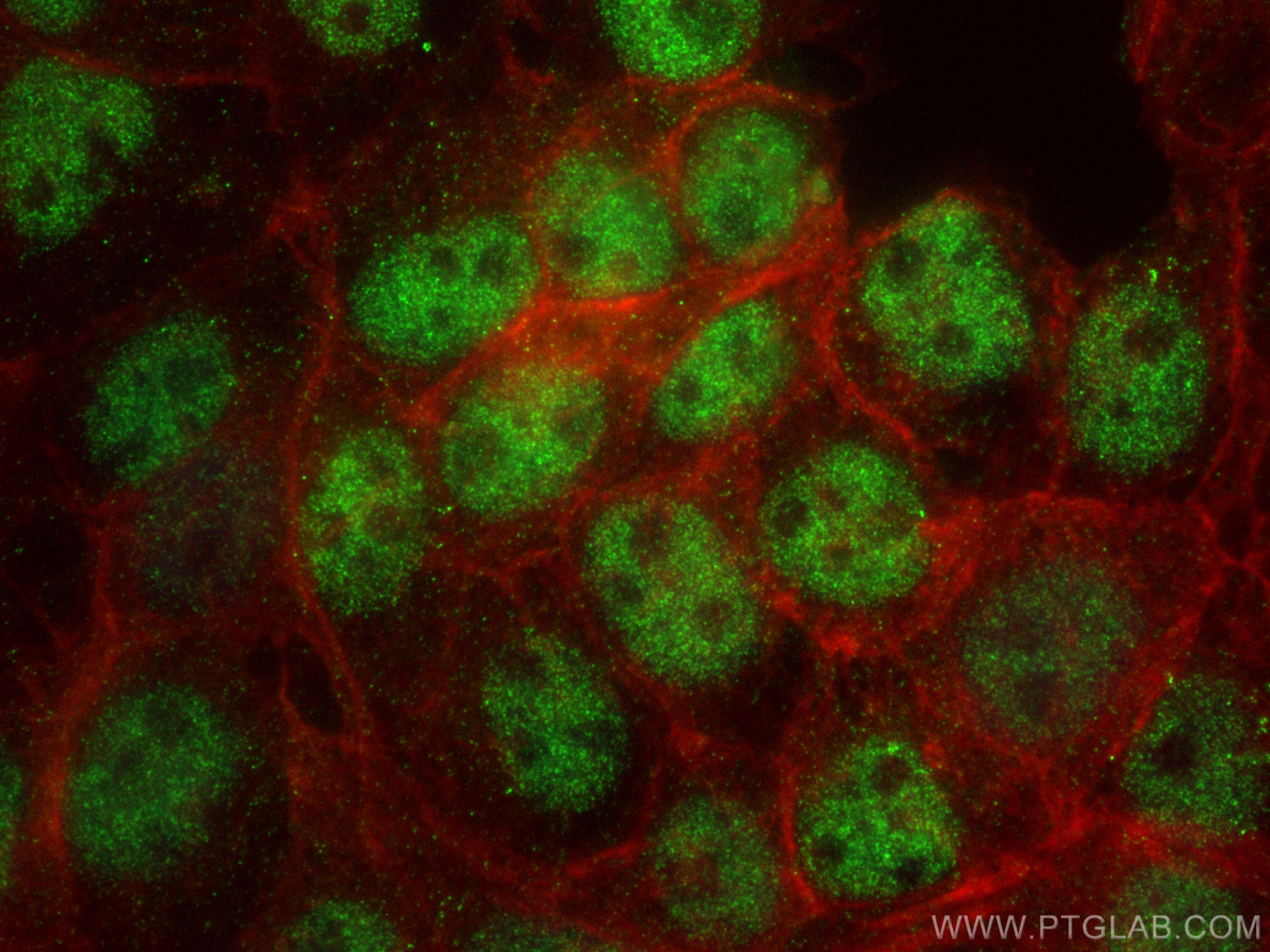 Immunofluorescence (IF) / fluorescent staining of A431 cells using ZHX2 Monoclonal antibody (68268-1-Ig)