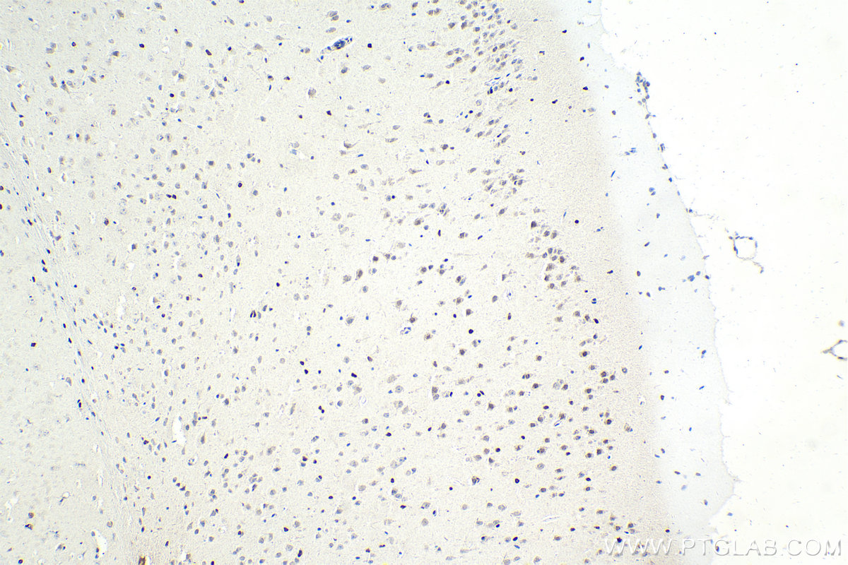 Immunohistochemistry (IHC) staining of mouse brain tissue using ZHX2 Monoclonal antibody (68268-1-Ig)