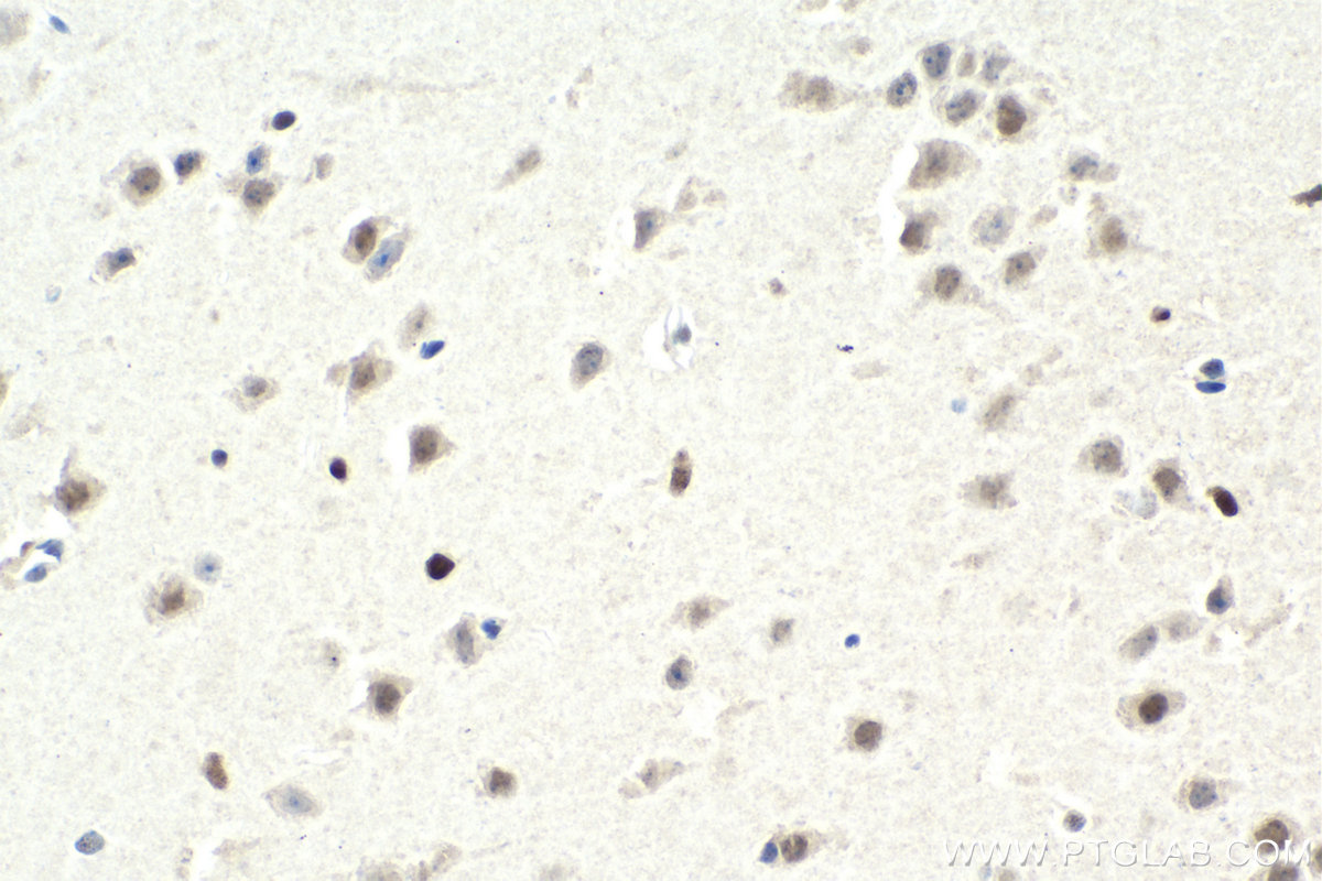 Immunohistochemistry (IHC) staining of mouse brain tissue using ZHX2 Monoclonal antibody (68268-1-Ig)