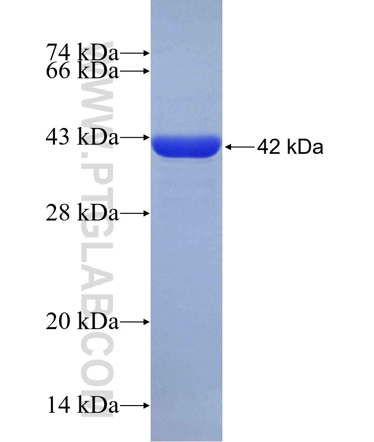 ZHX3 fusion protein Ag30023 SDS-PAGE