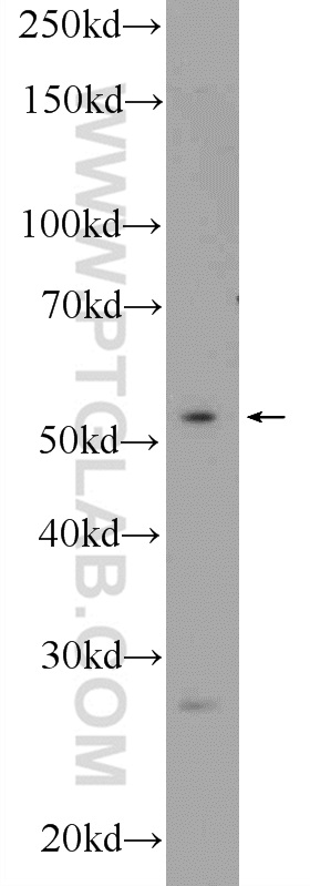 Western Blot (WB) analysis of Y79 cells using ZIC1 Polyclonal antibody (25004-1-AP)