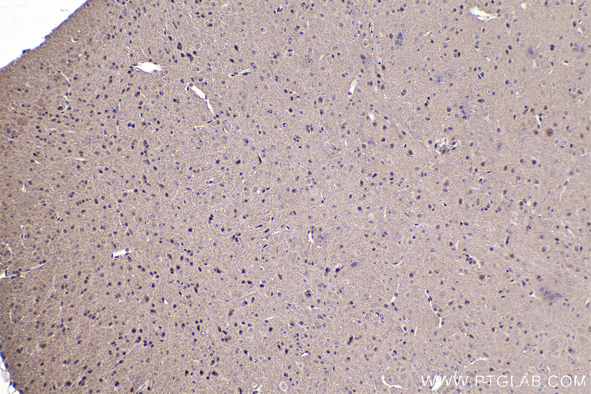 Immunohistochemistry (IHC) staining of mouse brain tissue using ZIC3 Polyclonal antibody (21717-1-AP)