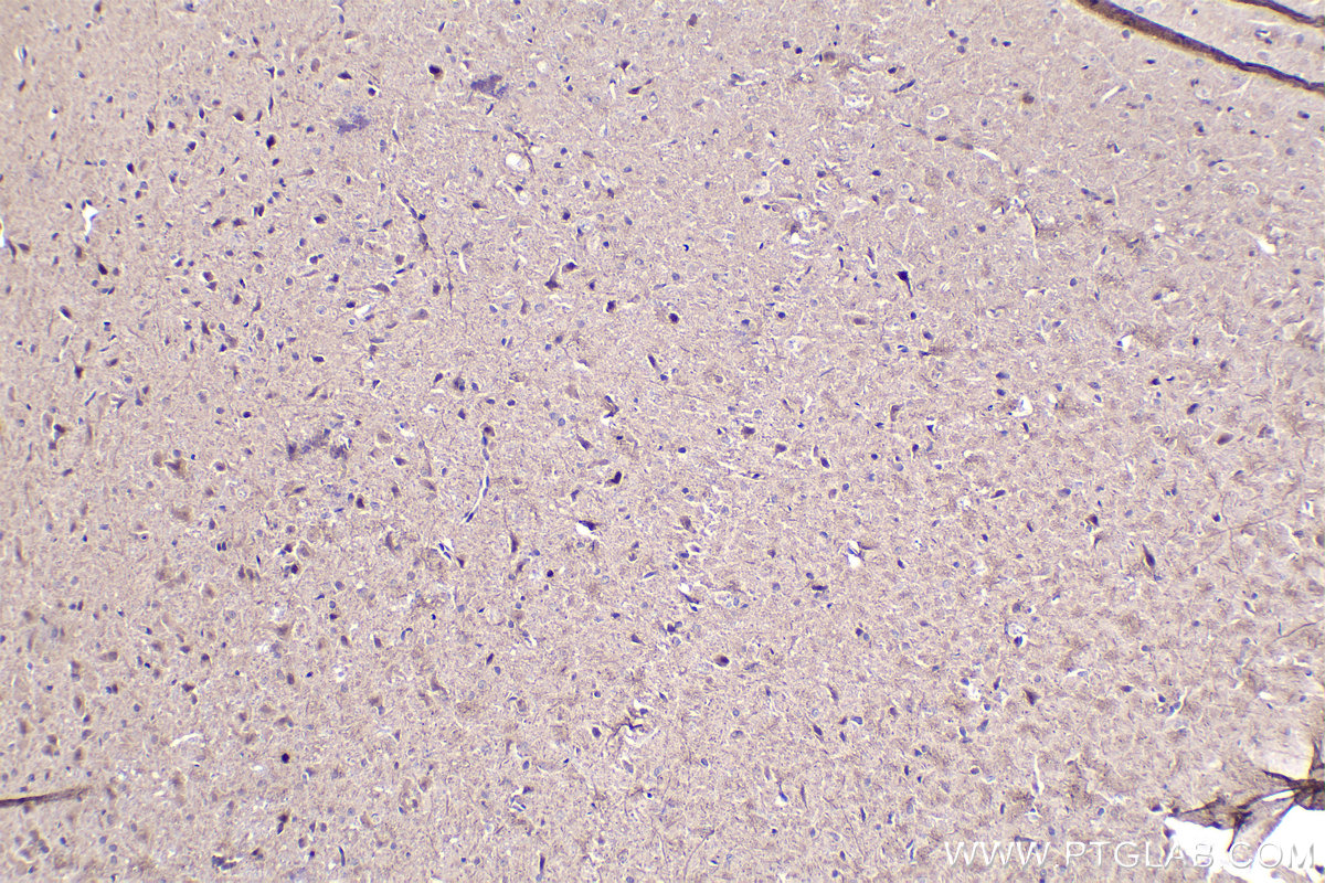 Immunohistochemistry (IHC) staining of rat brain tissue using ZIC3 Polyclonal antibody (21717-1-AP)