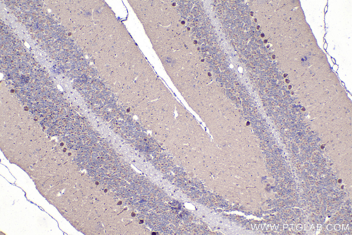 Immunohistochemistry (IHC) staining of rat cerebellum tissue using ZIC3 Polyclonal antibody (21717-1-AP)