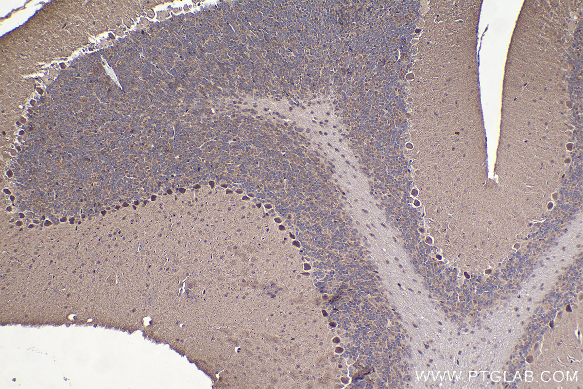 Immunohistochemistry (IHC) staining of mouse cerebellum tissue using ZIC3 Polyclonal antibody (21717-1-AP)