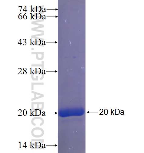 ZIM2 fusion protein Ag23353 SDS-PAGE