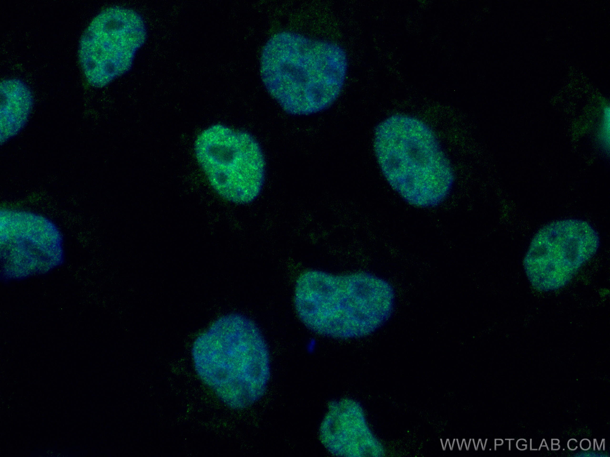 Immunofluorescence (IF) / fluorescent staining of A431 cells using CoraLite® Plus 488-conjugated ZKSCAN1 Polyclonal a (CL488-25214)