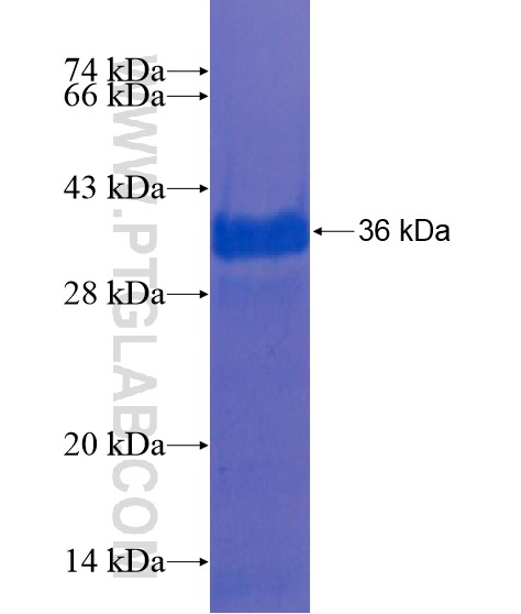 ZKSCAN2 fusion protein Ag21787 SDS-PAGE