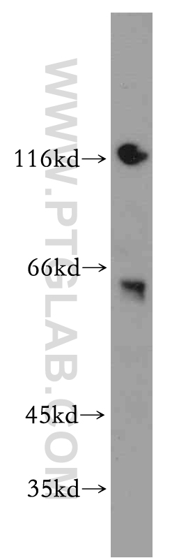 Western Blot (WB) analysis of mouse brain tissue using ZKSCAN3 Polyclonal antibody (20800-1-AP)