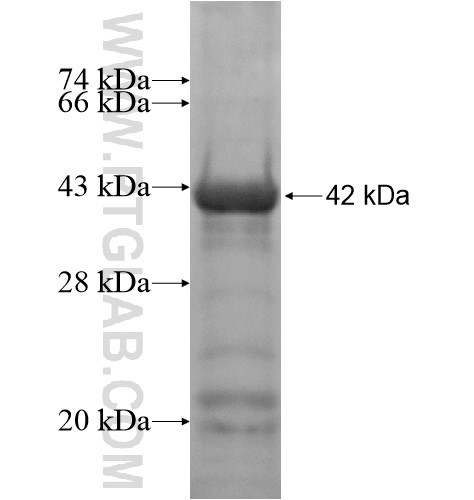 ZKSCAN5 fusion protein Ag14427 SDS-PAGE