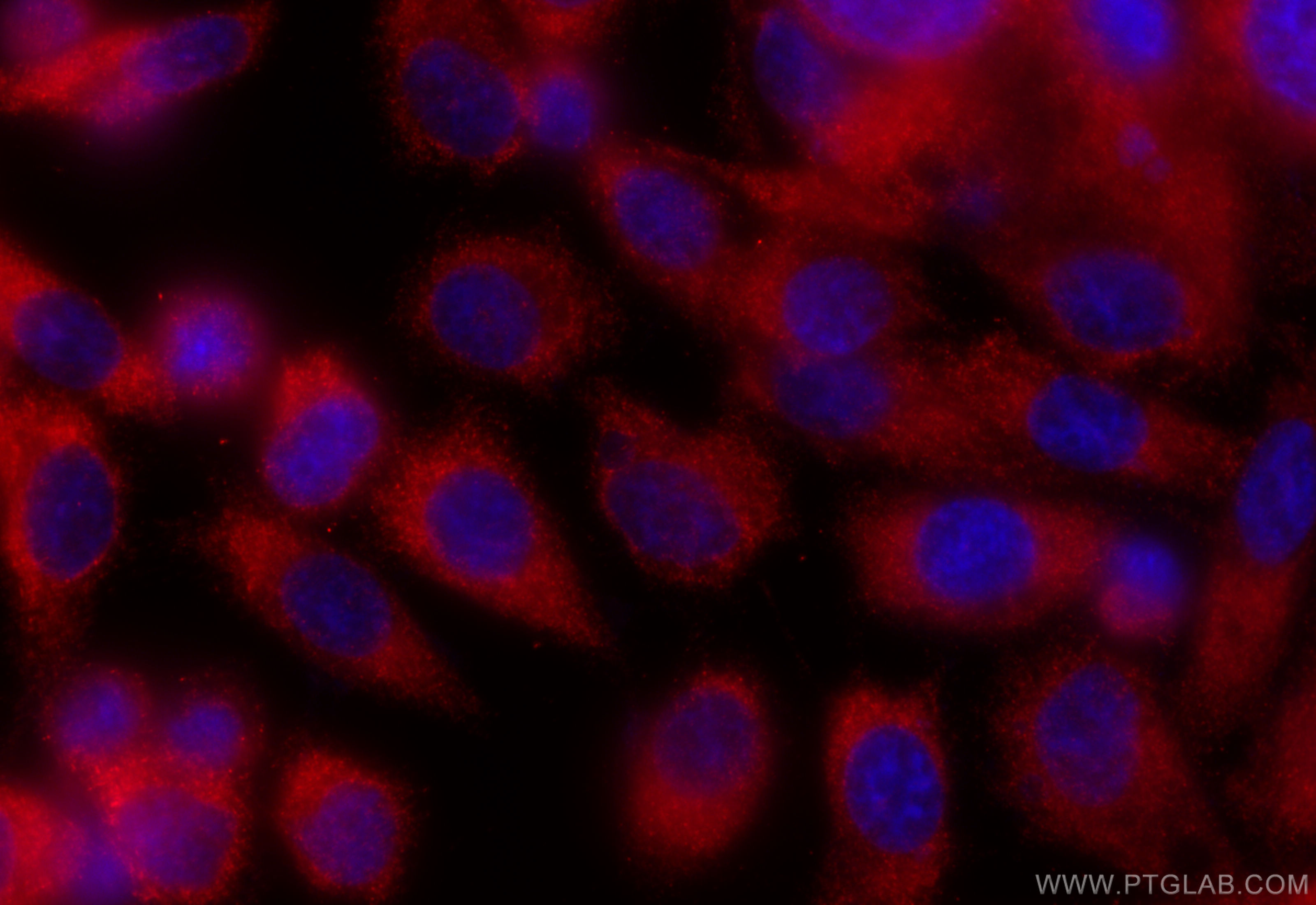 Immunofluorescence (IF) / fluorescent staining of PC-3 cells using ZMPSTE24 Recombinant antibody (84547-2-RR)