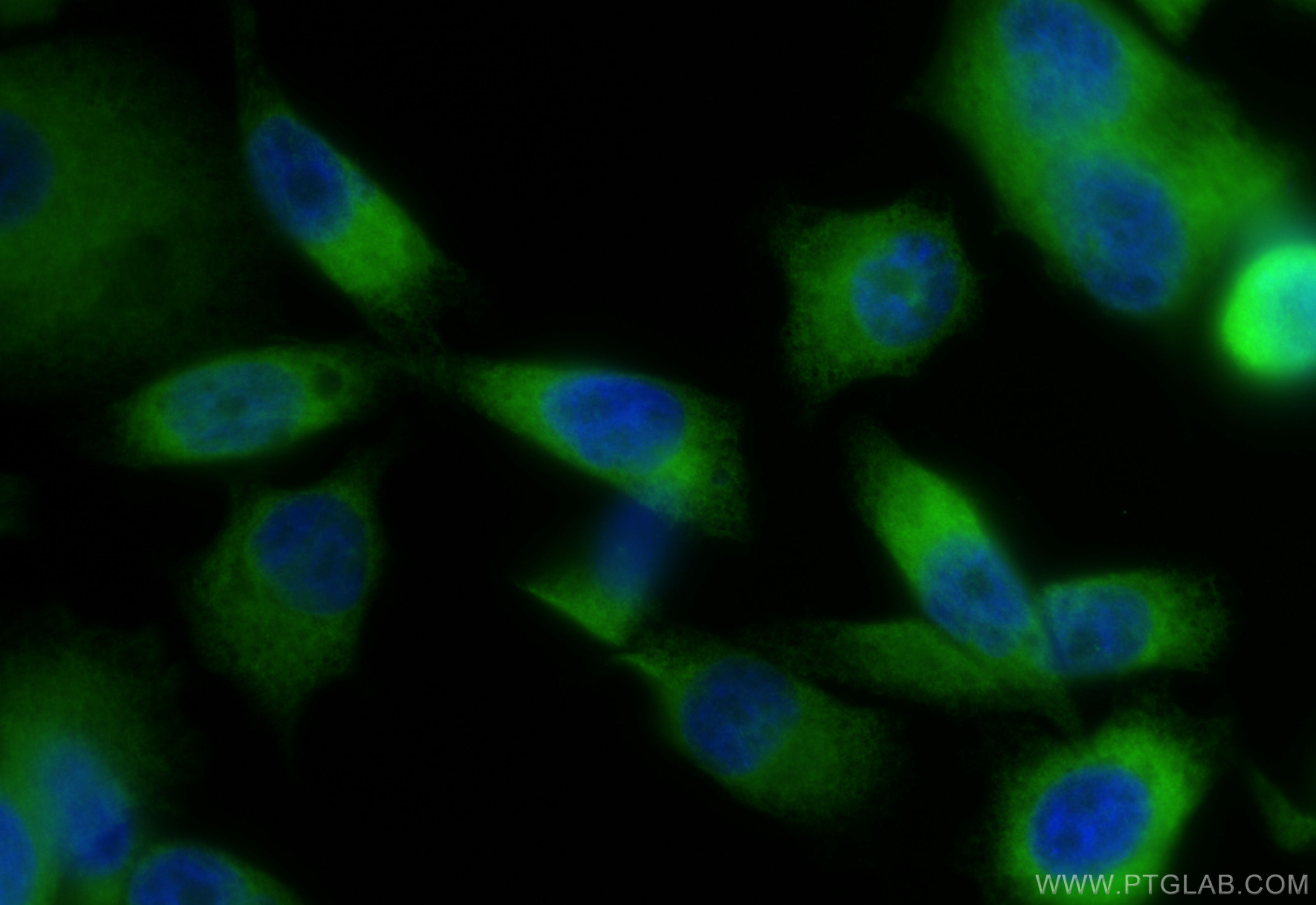 Immunofluorescence (IF) / fluorescent staining of PC-3 cells using CoraLite® Plus 488-conjugated ZMPSTE24 Recombinant (CL488-84547-2)