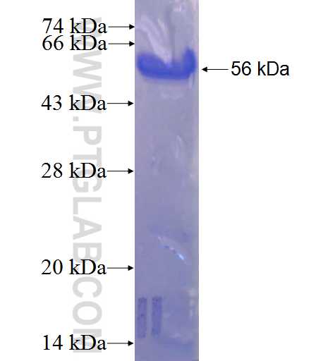 ZMYM3 fusion protein Ag22777 SDS-PAGE