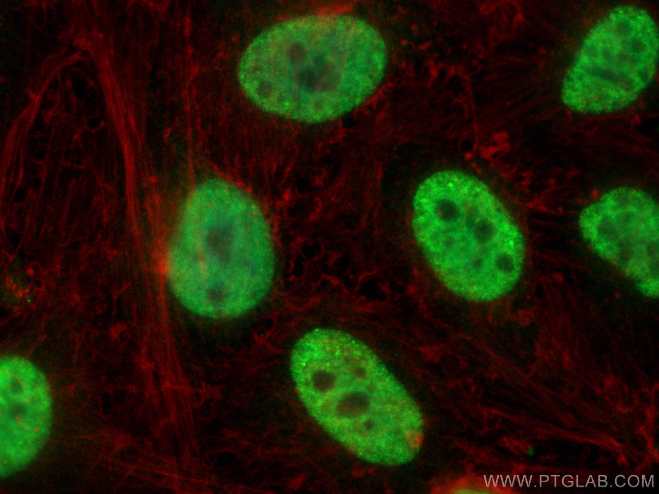 Immunofluorescence (IF) / fluorescent staining of HeLa cells using ZNF101 Polyclonal antibody (25599-1-AP)